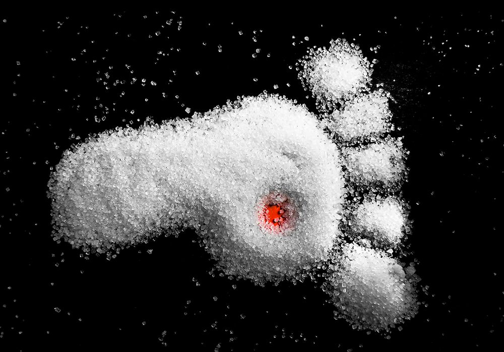 Diabetisches_Fusssyndrom.jpg